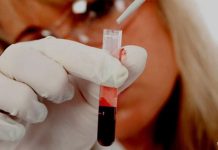 Учеными найден способ определить скорость старения и вероятность смерти