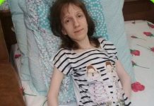 Оксана Близгарева из Волгограда на грани истощения от потери веса