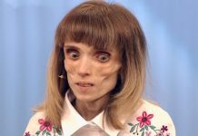 Кристина Корягина продолжает вести борьбу с анорексией