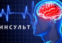 Почему инсульты случаются у людей молодого и среднего возраста? Всё чаще инсульты настигают людей в расцвете сил