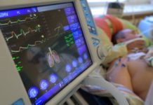Сколько пациентов выживают после подключения к ИВЛ аппаратура
