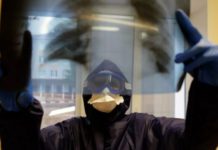 5 способов как укрепить легкие до и после ковида снимок на рентгене