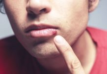 Откуда это взялось: как избавиться от герпеса сыпь на губах