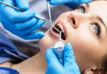 Рецессия десны: 8 причин, 2 типа лечения лечение рецессии десны