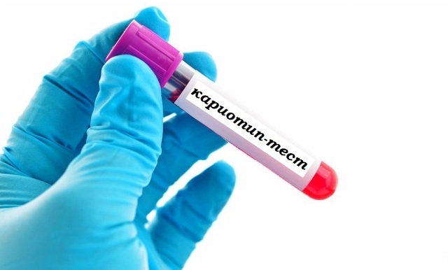 комплексное тестирование кариотипа исследование кариотипа
